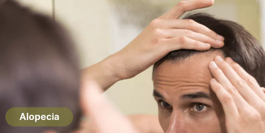 Tips para evitar la alopecia