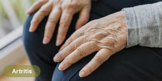 Estrategias naturales y efectivas para el alivio de la artritis